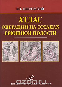 Скачать книгу "Атлас операций на органах брюшной полости, В. В. Жеброский"