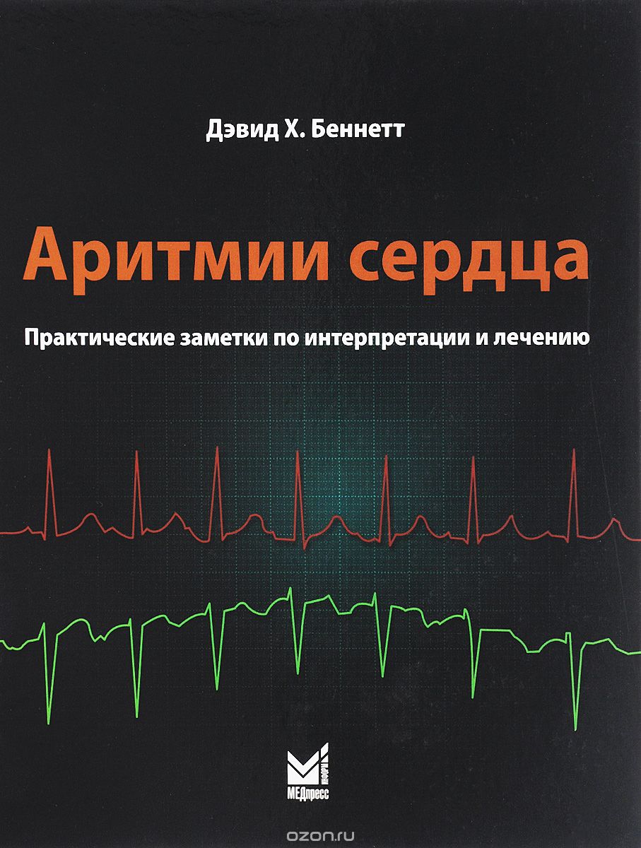 Аритмии сердца. Практические заметки по интерпретации и лечению, Дэвид Х. Беннетт