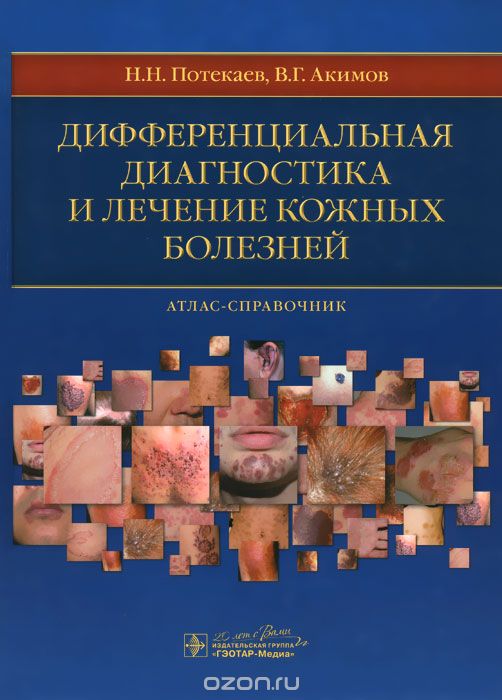 Скачать книгу "Дифференциальная диагностика и лечение кожных болезней, Н. Н. Потекаев, В. Г. Акимов"