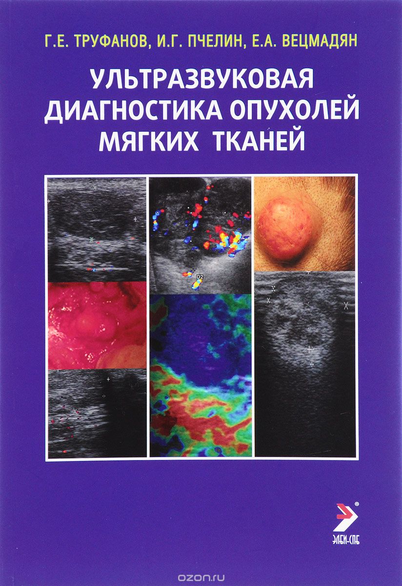 Ультразвуковая диагностика опухолей мягких тканей, Г. Е. Труфанов, И. Г. Пчелин, Е. А. Вецмадян
