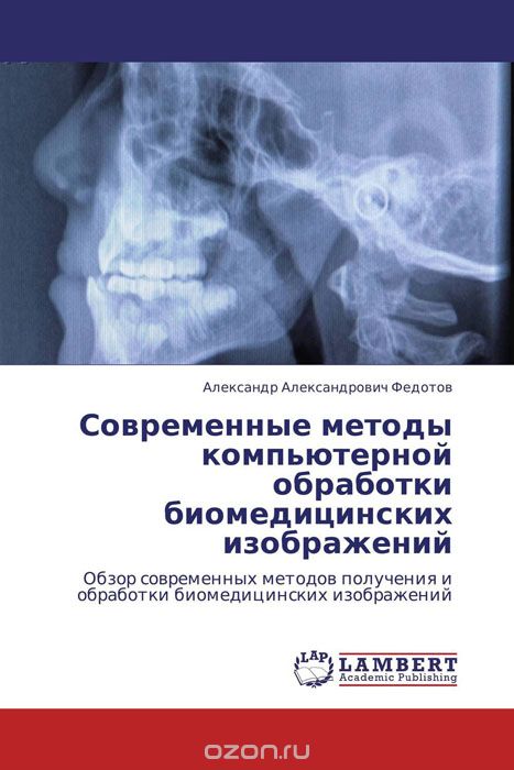 Скачать книгу "Современные методы компьютерной обработки биомедицинских изображений, Александр Александрович Федотов"