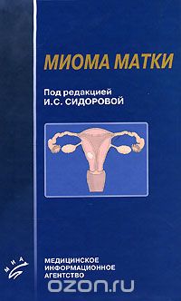 Скачать книгу "Миома матки, Под редакцией И. С. Сидоровой"