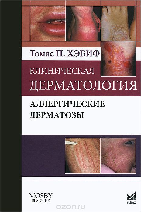Скачать книгу "Клиническая дерматология. Аллергические дерматозы, Томас П. Хэбиф"
