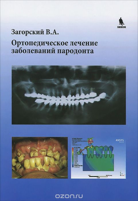 Скачать книгу "Ортопедическое лечение заболеваний пародонта, В. А. Загорский"