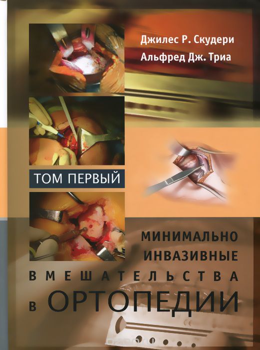Минимально инвазивные вмешательства в ортопедии. В 2 томах. Том 1, Джилес Р. Скудери, Альфред Дж. Триа
